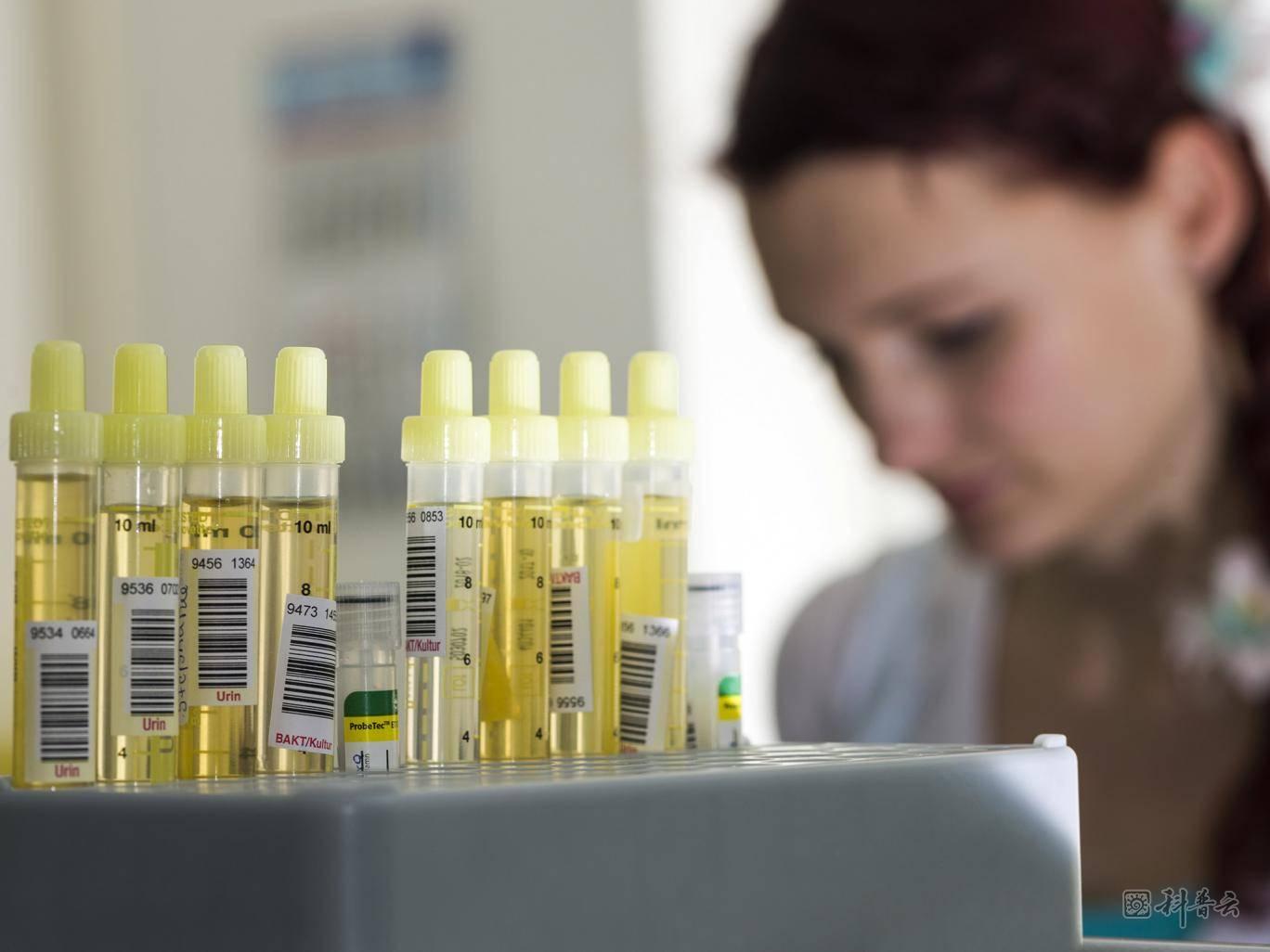 Urine-test-rexfeature.jpg
